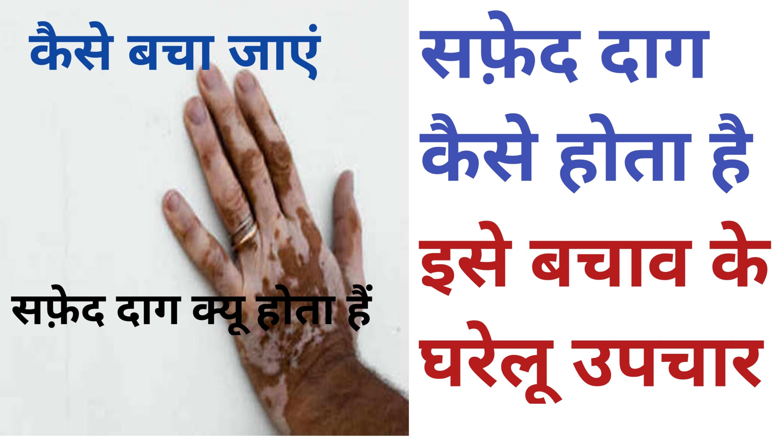 Safed daag kyu hota hai
